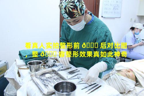 看真人实拍整形前 🐋 后对比图，整 🐕 容整形效果真如此神奇